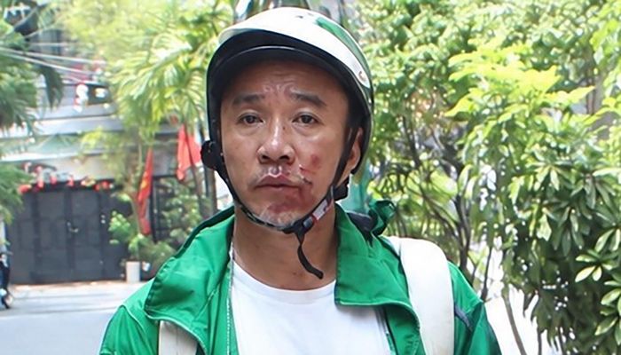 Hoàng "Bác Sĩ" vừa bị Công an TPHCM bắt vì cướp giật tài sản, kéo lê nạn nhân. Ảnh: CATP
