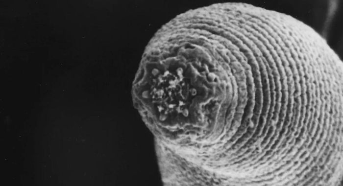 Phần đầu của Halicephalobus mephisto. Ảnh: Gaetan Borgonie