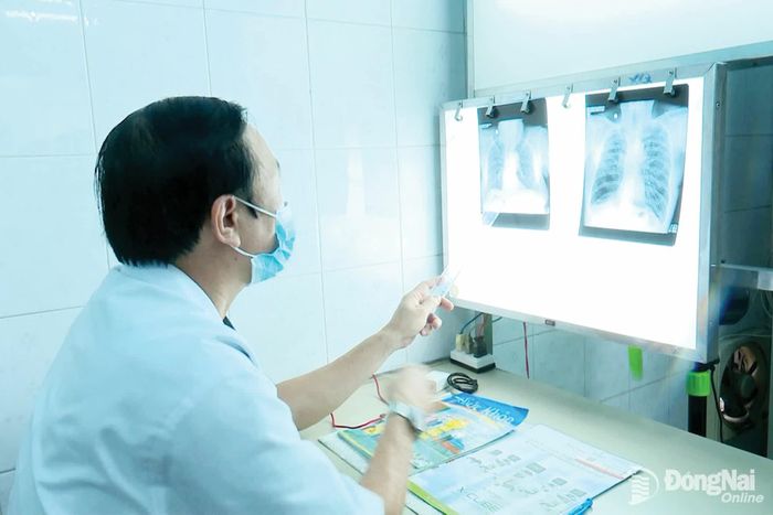Nhân viên y tế Bệnh viện Phổi Đồng Nai đọc kết quả chụp X-quang phổi của người dân để tầm soát bệnh hen phế quản và phổi tắc nghẽn mạn tính.