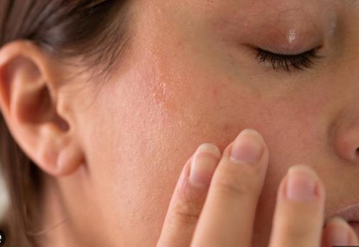 Khi da xuất hiện dấu hiệu dị ứng, việc xử lý đúng cách sẽ giúp hạn chế tổn thương và rút ngắn thời gian phục hồi.