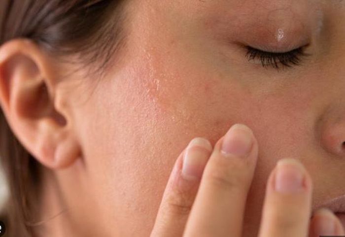 Khi da xuất hiện dấu hiệu dị ứng, việc xử lý đúng cách sẽ giúp hạn chế tổn thương và rút ngắn thời gian phục hồi.