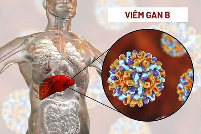 Viêm gan B là bệnh truyền nhiễm do virus viêm gan B (HBV) gây ra, ảnh hưởng trực tiếp đến tế bào gan. Ảnh AI