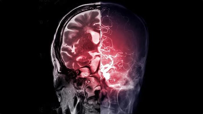 Não bộ mới chính là trung tâm điều khiển quan trọng giúp metformin phát huy tác dụng hạ đường huyết khi sử dụng ở liều lượng điều trị thông thường. Hình minh họa: Shutterstock
