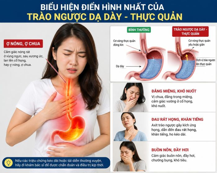 Những triệu chứng giúp nhận biết sớm trào ngược dạ dày - thực quản (Ảnh AI).