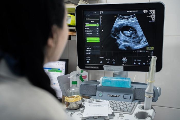 Đây là lần thứ hai chị thực hiện hành trình IVF tại Bệnh viện Bưu Điện. Bốn năm trước, sau nhiều năm mong con, hai vợ chồng đến khám và được xác định nguyên nhân vô sinh từ người chồng không có tinh trùng. Dù đã trải qua phẫu thuật tìm tinh trùng nhưng không đạt kết quả như mong muốn, gia đình quyết định xin tinh trùng từ ngân hàng tinh trùng để thực hiện IVF và may mắn đón con đầu lòng.