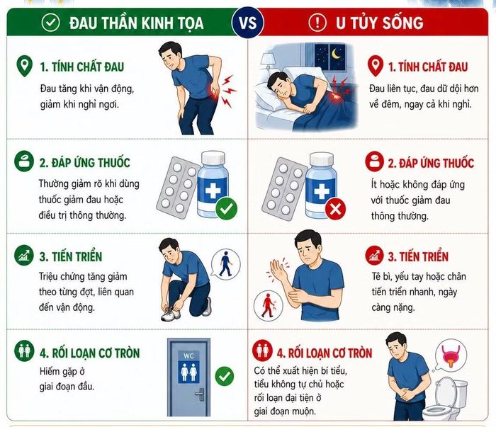 Sự giống và khác nhau giữa đau thần kinh tọa và u tủy sống - Hình minh họa BVCC