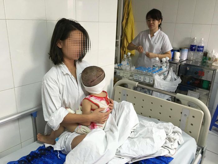 Bệnh nhi trong những ngày điều trị hậu phẫu tại Bệnh viện Hữu nghị Việt Đức. Ảnh: BVCC
