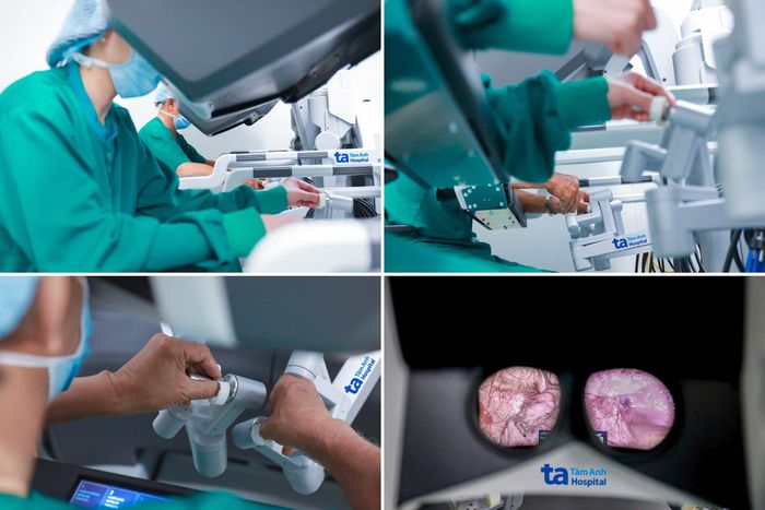 Robot Da Vinci Xi với công nghệ Mỹ được FDA (Mỹ) chứng nhận độ ổn định, tính chính xác và an toàn tuyệt đối qua hơn 14 triệu ca mổ thành công trên toàn thế giới. Ảnh: Bệnh viện Đa khoa Tâm Anh