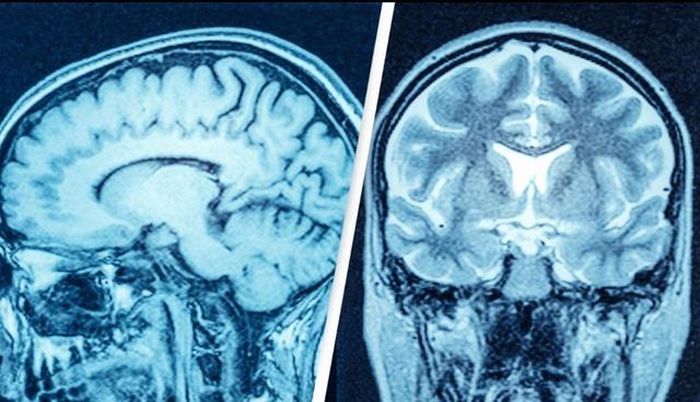  CT/MRI của bệnh nhân. Ảnh: Reuters.