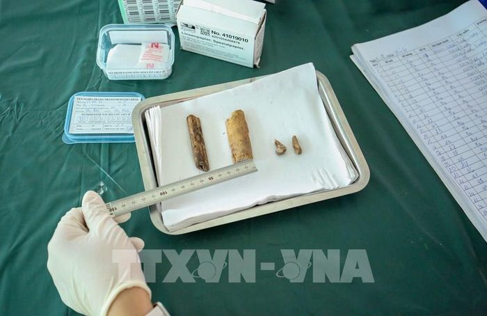 Từng mẫu xương được nhân viên y tế quan sát, lựa chọn cẩn trọng nhằm bảo đảm chất lượng phục vụ giám định ADN. Ảnh: Giang Phương – TTXVN