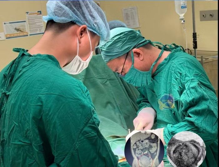 Ê-kíp phẫu thuật cho bệnh nhân - Ảnh BVCC
