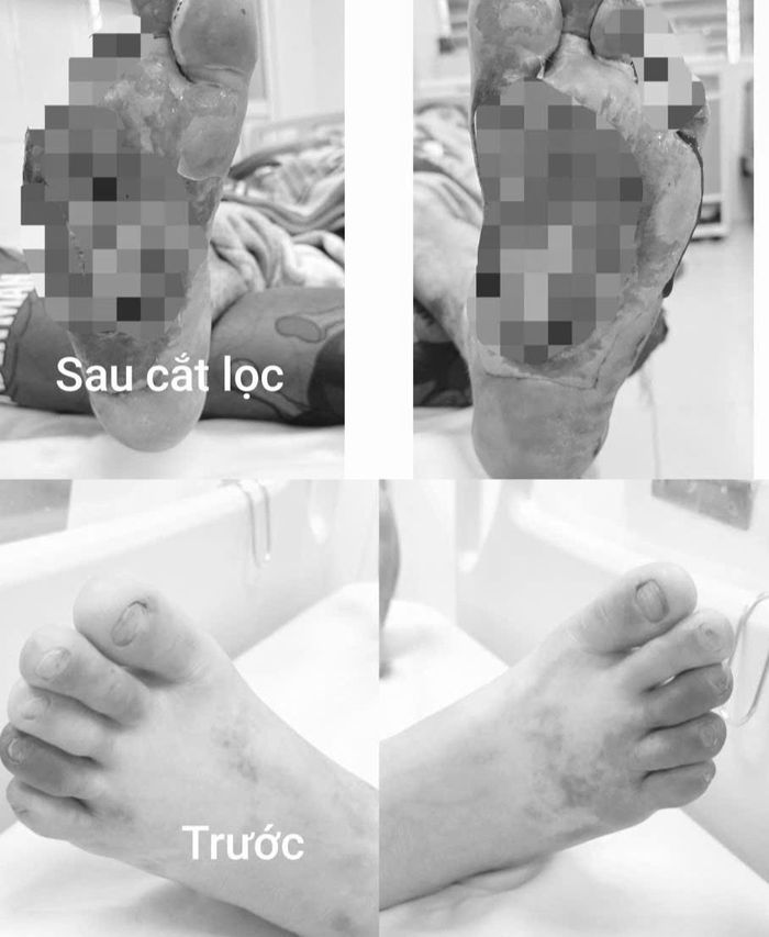 Vết thương của bệnh nhân trước và sau khi được phẫu thuật. Ảnh: BVCC.