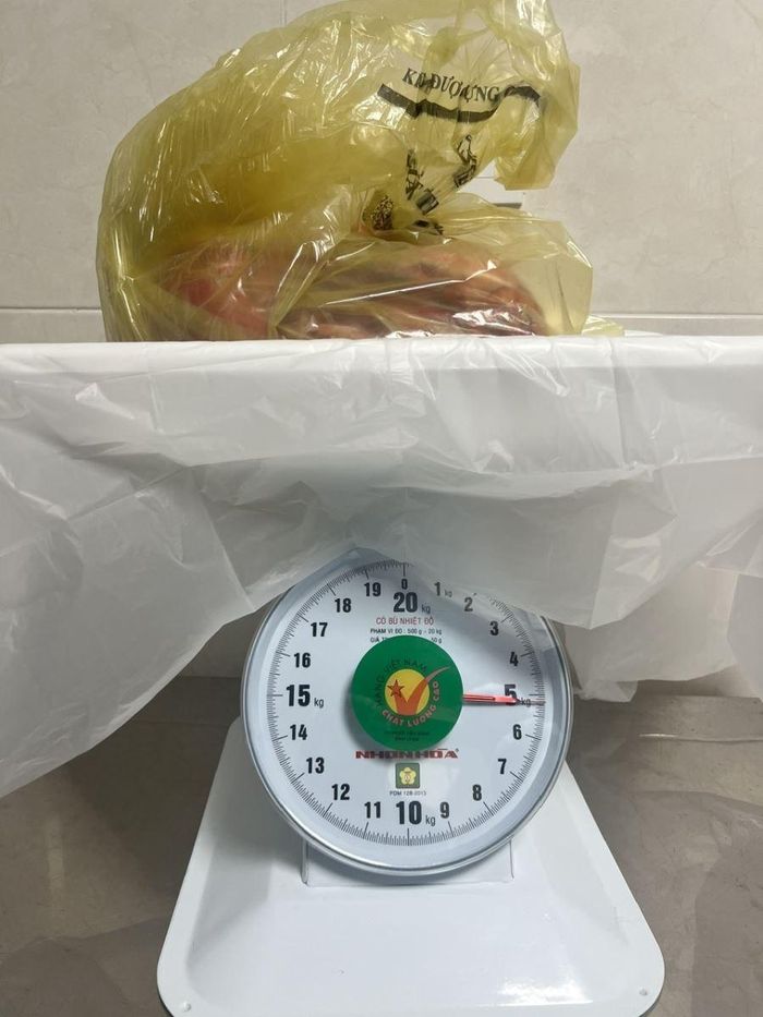 Khối u nặng hơn 5kg được bác sĩ phẫu thuật bóc tách thành công. Ảnh: BV
