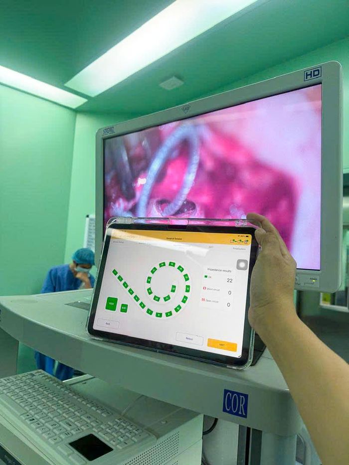 Ê kíp kiểm tra hệ thống điện cực trong quá trình phẫu thuật cấy điện cực ốc tai (Ảnh: BV ĐHYD)