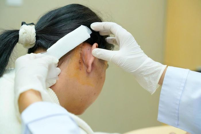 Người bệnh được kiểm tra vết mổ sau phẫu thuật cấy điện cực ốc tai (Ảnh: BV ĐHYD)