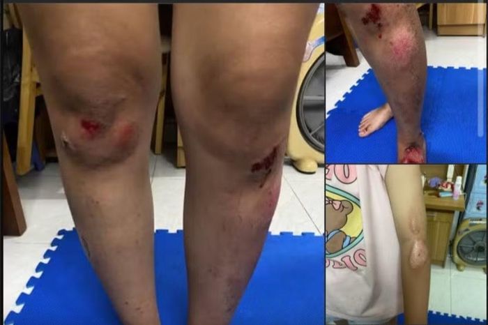 Hình ảnh được người dân đăng tải lên mạng xã hội.