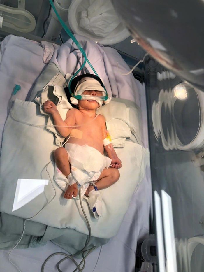  Bé gái được chăm sóc đặc biệt, hỗ trợ hô hấp bằng máy thở. 