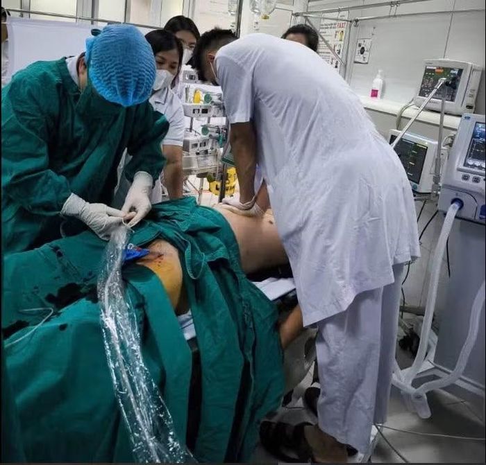 Thiết lập hệ thống ECMO để cứu bệnh nhân - Ảnh BVCC