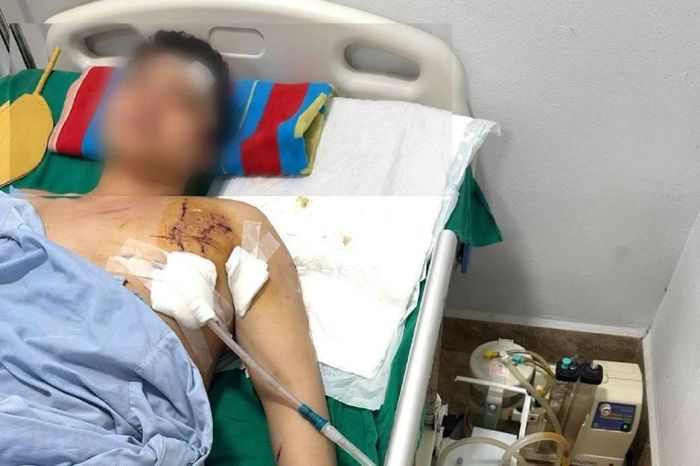 Bệnh nhân bị tai nạn giao thông và nhập viện trong tình trạng lơ mơ, giảm ý thức, có nhiều vết thương phức tạp, mất nhiều máu.