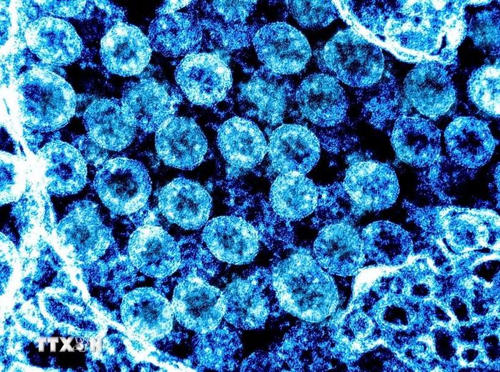 Virus SARS-CoV-2 trong mẫu bệnh phẩm của bệnh nhân mắc COVID-19. (Ảnh: AFP/TTXVN)