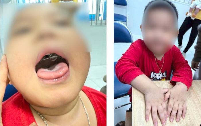 Bệnh nhi thăm khám sau thời gian điều trị. (Ảnh: BVCC)