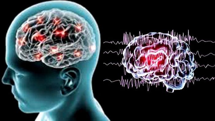 Động kinh là một trong những bệnh lý thần kinh thường gặp ở trẻ em. Ảnh AI.