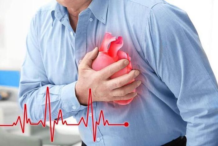 Triệu chứng điển hình nhất của bệnh mạch vành là đau thắt ngực với cảm giác nặng ngực, đè ép hoặc bóp nghẹt sau xương ức. Ảnh minh họa