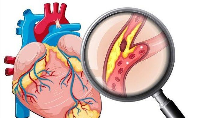 Người bệnh cần tái khám định kỳ và luôn mang theo đơn thuốc hoặc hồ sơ điều trị trong mỗi lần khám để bác sĩ đánh giá hiệu quả điều trị và điều chỉnh phác đồ khi cần thiết. Ảnh minh họa