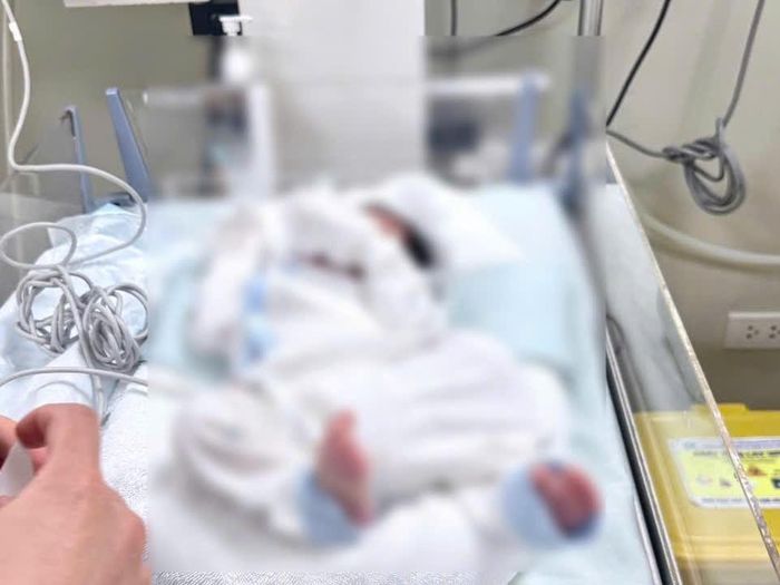 Cháu bé được cấp cứu kịp thời. Ảnh: CA.