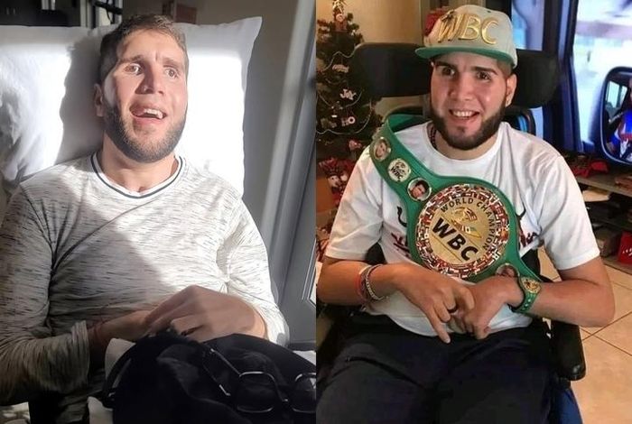 Prichard Colon phải chống chọi với di chứng từ trận đấu.