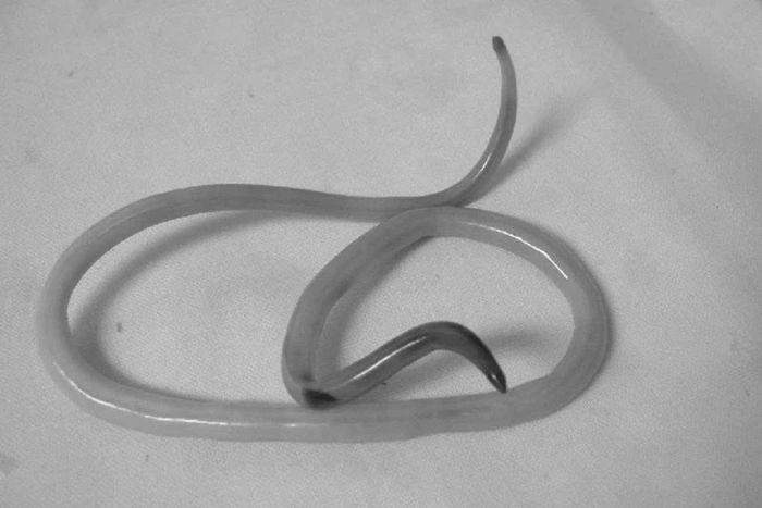 Giun đũa có tên khoa học là Ascaris lumbricoides, thường ký sinh tại ruột non của người. Ảnh: BVCC.