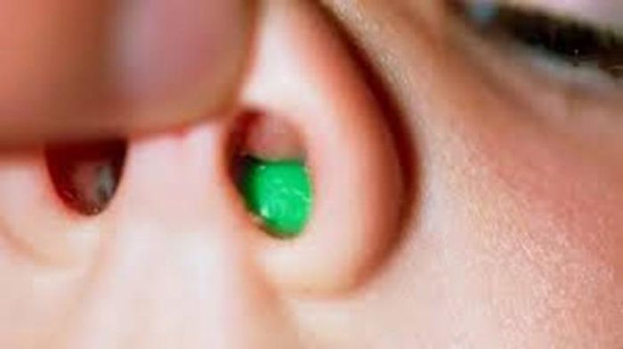 Dị vật trong mũi là tình trạng khá thường gặp, đặc biệt ở trẻ nhỏ. Ảnh BSCC