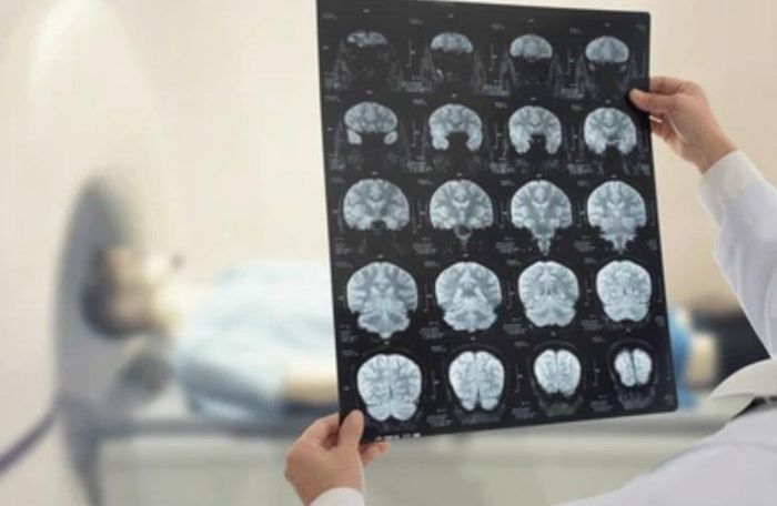 Trí tuệ nhân tạo (AI) có thể giúp đưa ra gợi ý về loại xét nghiệm y tế mà bác sĩ nên thực hiện. Ảnh: Wikimedia Commons