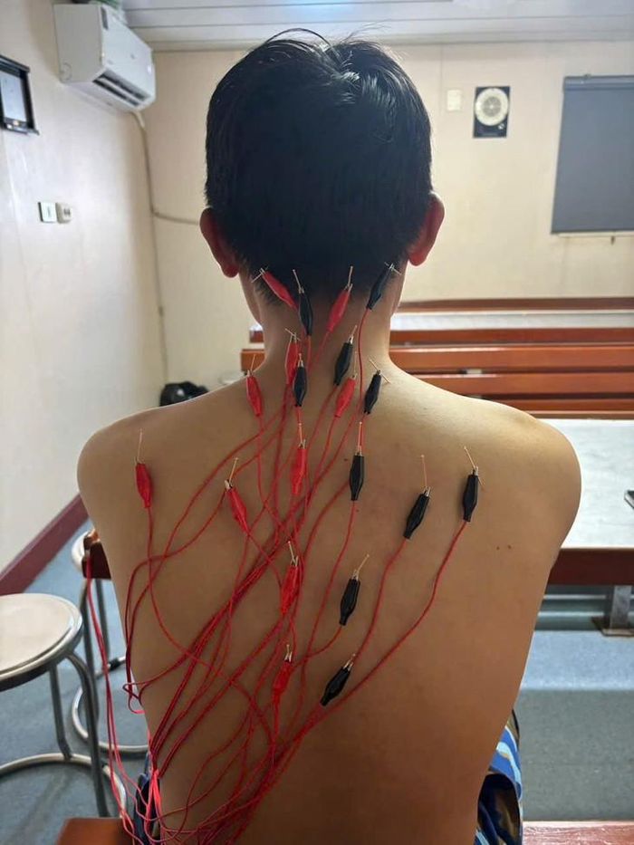 Kết thúc chuyến công tác, những dụng cụ châm cứu được tặng lại để các cán bộ có thêm điều kiện tiếp tục ứng dụng phương pháp này trong chăm sóc sức khỏe quân và dân.