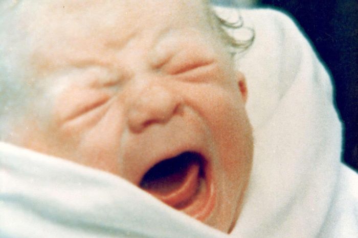 Louise Joy Brown được sinh bằng phương pháp mổ lấy thai ngày 25/7/1978 tại Bệnh viện Đa khoa Oldham, Lancashire, Anh. Ảnh: Keystone/Getty.