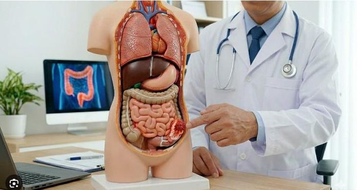 Ung thư đại tràng đáng sợ, nhưng điều đáng sợ hơn là phát hiện bệnh khi đã muộn. Ảnh minh họa A.I