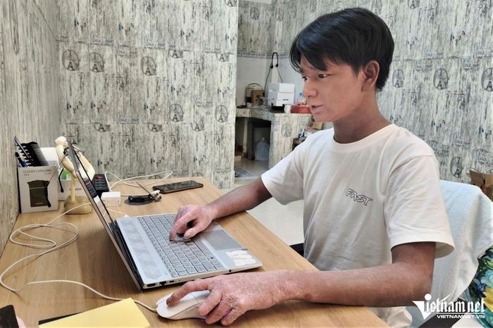 Cậu bé “người rắn” từng bị bạn bè xa lánh, nay đã thành tân sinh viên.