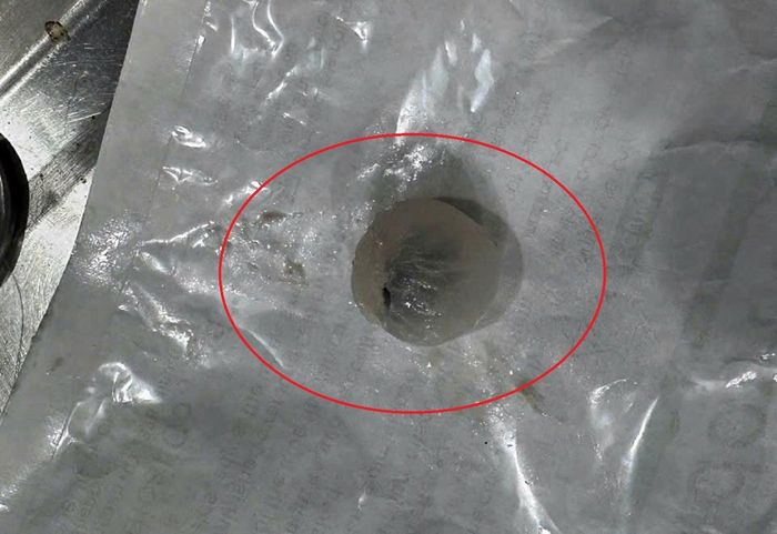 Quả nhãn bị mắc ở khí quản bệnh nhi (Ảnh: BVCC)