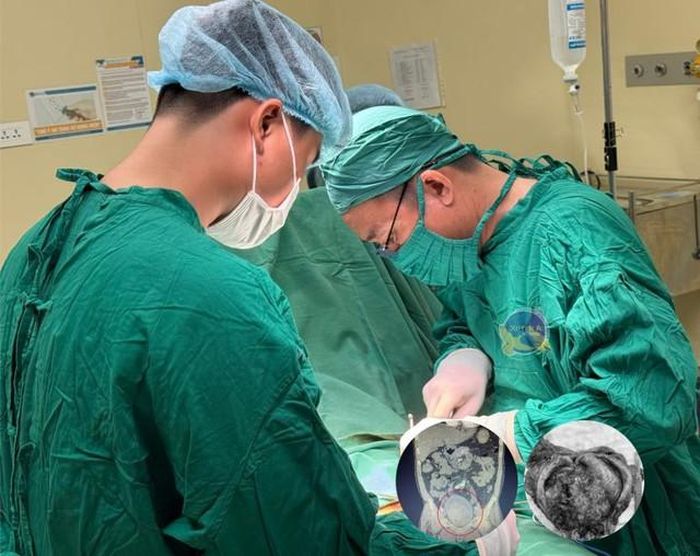 Ảnh ghi nhận trong ca phẫu thuật cắt bỏ bàng quang. Ảnh: BVCC