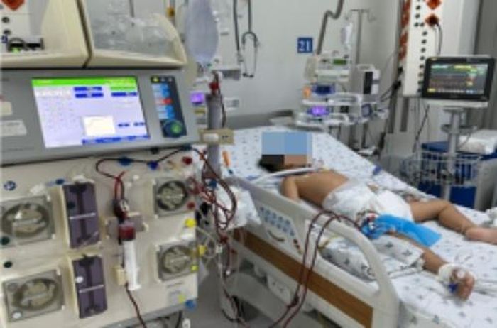  Bệnh nhi phải thở máy vì suy hô hấp. Ảnh: BVCC.