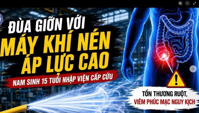 Ảnh minh họa BVCC