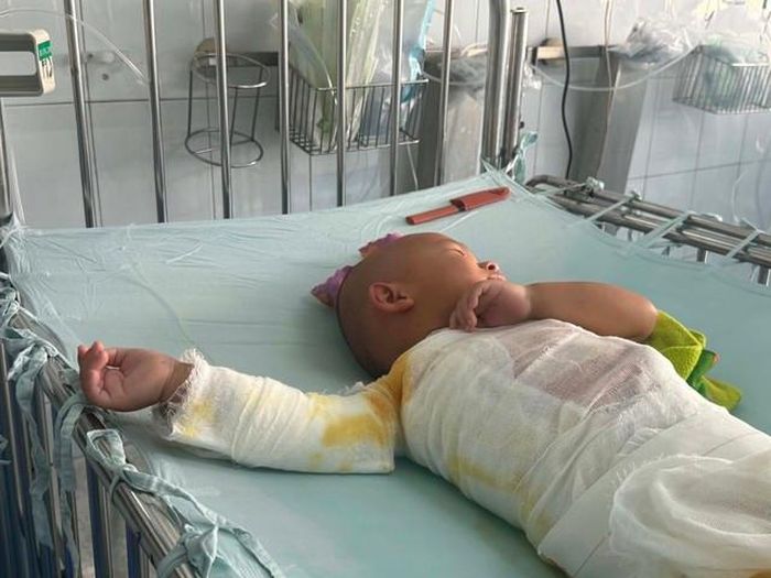 Việc điều trị của bé Nhân còn dài cần sự chung tay của cộng đồng
