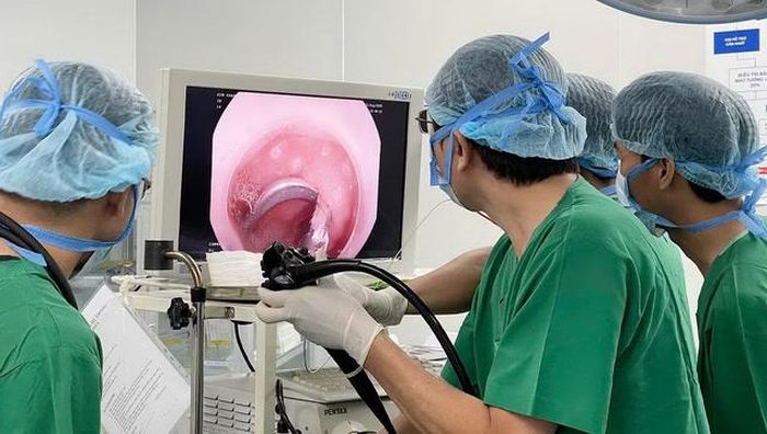 Ê-kíp bác sĩ Bệnh viện 22-12 nội soi lấy dị vật cho bệnh nhi. Ảnh: BVCC.