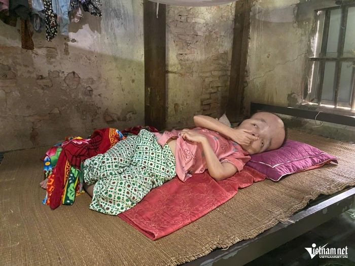 Chị Hằng nằm bất động trên giường suốt hơn 30 năm qua