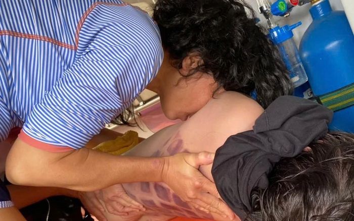 Thời khắc đưa bé trai Yukiji từ hồ bơi lên cấp cứu ... Ảnh: Liên Trần