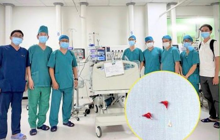 Ê kíp phối hợp giữa 2 bệnh viện và ảnh chụp cận cảnh 03 mảnh xương lươn được lấy ra từ phế quản của bệnh nhi 7 tháng tuổi