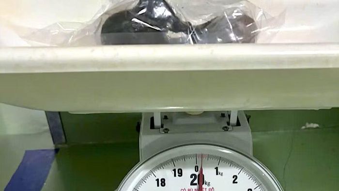 Khối tóc sau khi được lấy ra từ dạ dày bé Y và được cân kiểm tra. (Ảnh: Bệnh viện Sản-Nhi Cà Mau cung cấp)