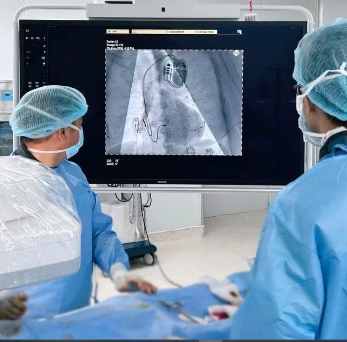 Cấy máy tạo nhịp tái đồng bộ cơ tim - Ảnh BVCC