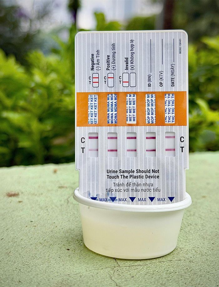 Đáng chú ý, lực lượng CSGT còn tập trung kiểm tra nồng độ cồn, test phản ứng với chất ma túy đối với các trường hợp lái xe kinh doanh vận tải. Kế hoạch nêu trên sẽ được CSGT cả nước triển khai từ ngày 26/8 đến ngày 25/9.