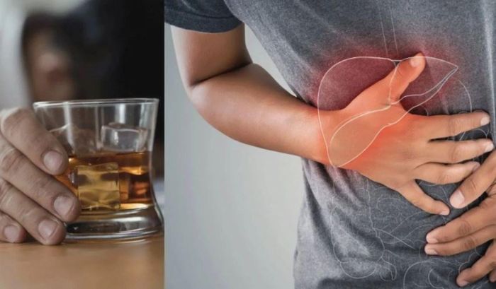 Tổn thương gan có thể xảy ra khi sử dụng lượng lớn rượu trong thời gian ngắn.